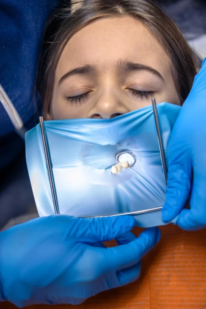 A professional close-up photograph showing an overhead clinical view of an active surgical procedure. A clinician's hands wearing blue protective gloves manage a treatment site isolated under a sterile blue rubber dam system with a metal frame clamp setup. This image represents the precise wisdom teeth extractions, advanced clinical isolation protocols, and specialized conservative oral surgery delivered at icónica dental group.