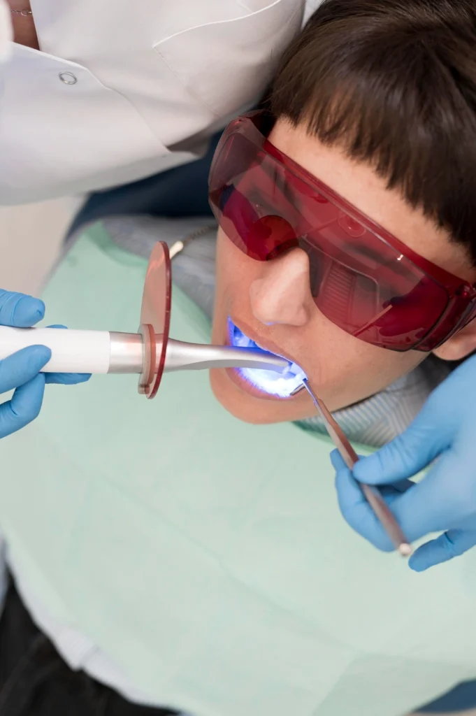 A professional close-up photograph showing an overhead clinical view of a preventative dental procedure. A female patient wearing red protective safety glasses and a teal bib is receiving treatment while a clinician in blue protective gloves utilizes an LED curing light with an orange shield and a dental mirror instrument. This image represents the advanced preventative sealants, conservative composite bonding, and modern technology systems utilized at icónica dental group.