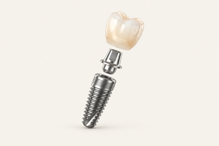 Exploded illustration of a single dental implant, connector, and replacement crown
