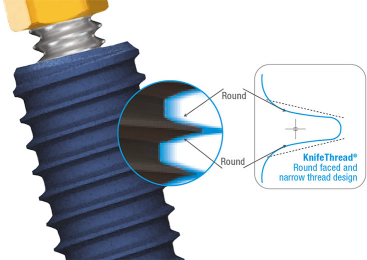MegaGen illustration showing the MiNi implant thread profile.