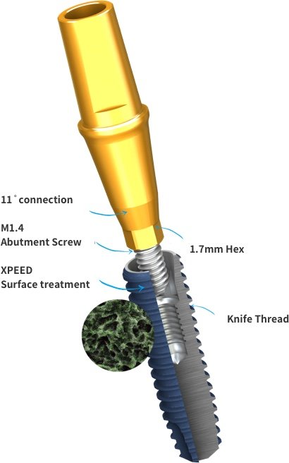 MegaGen MiNi implant and abutment component detail, shown in a manufacturer illustration.